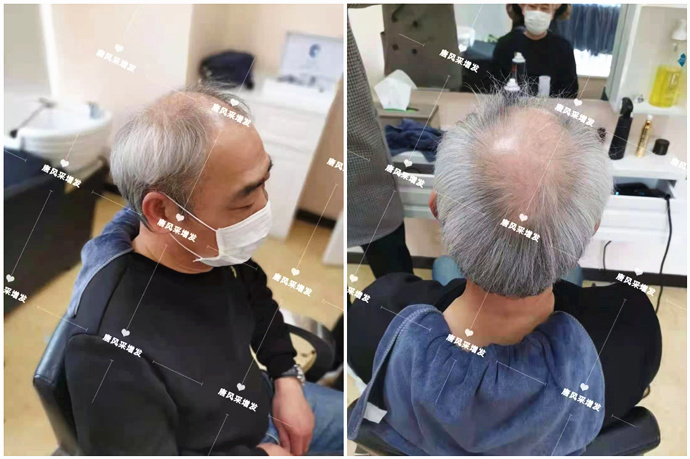 專業男士假發 \