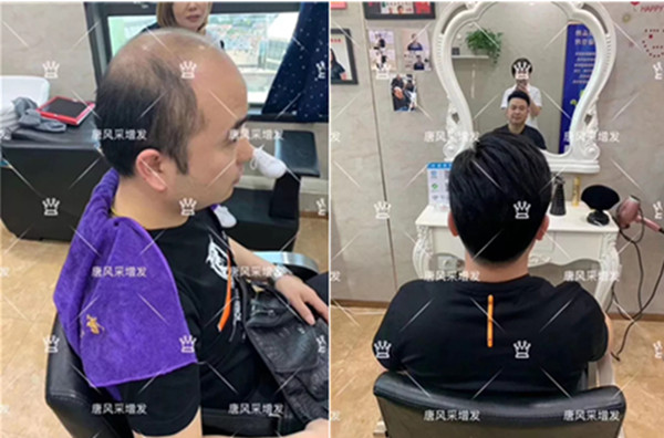 買假發需要注意哪些 \