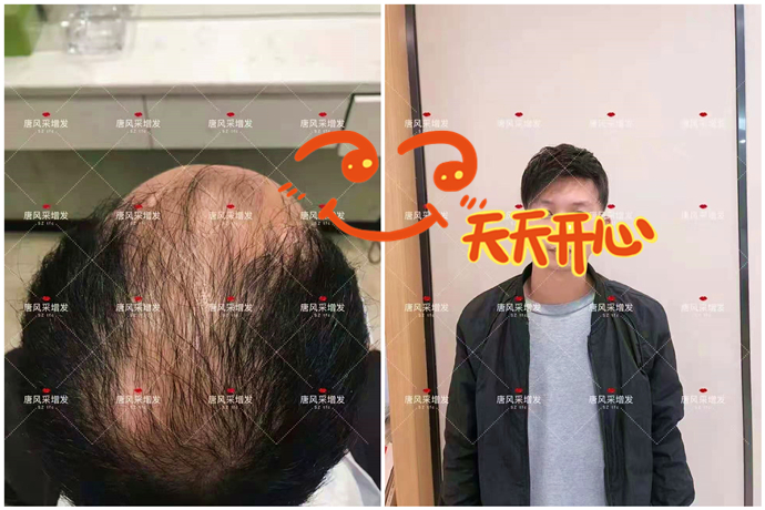 假發私人定制好在哪 \