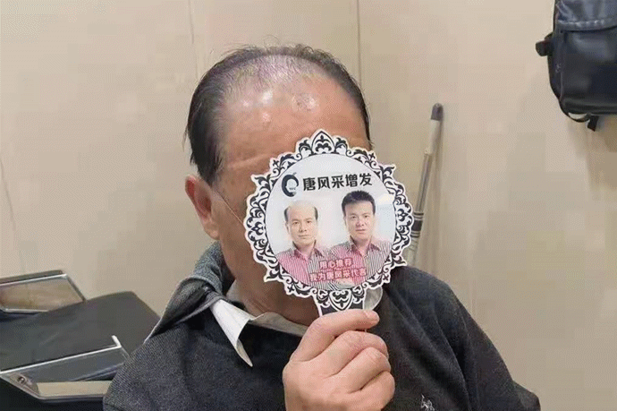 隱形補發 \