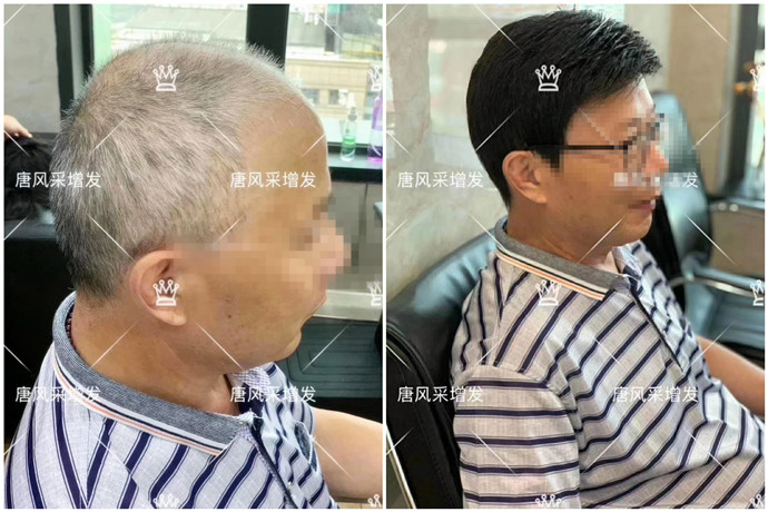 男士短假發價格 \