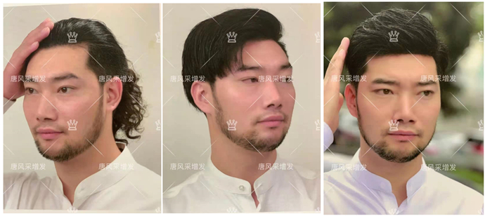 私人訂制無痕補發 \