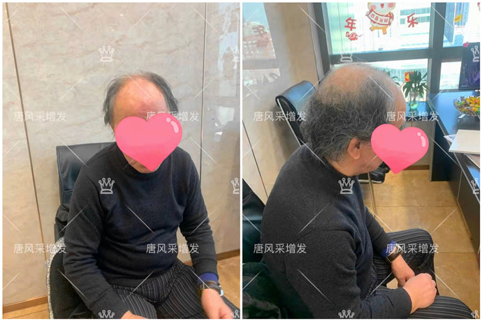 隱形增發 \