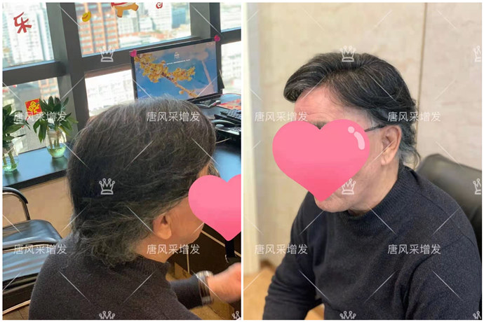 隱形增發 \