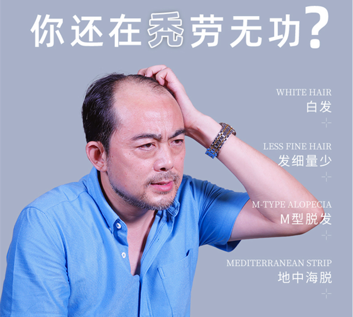 隱形假發 \