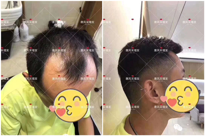 平頭的假發 \