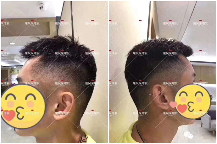 平頭的假發 \