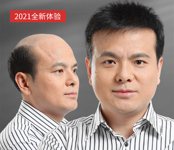 隱形增發 \