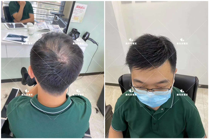 男士小平頭假發 \