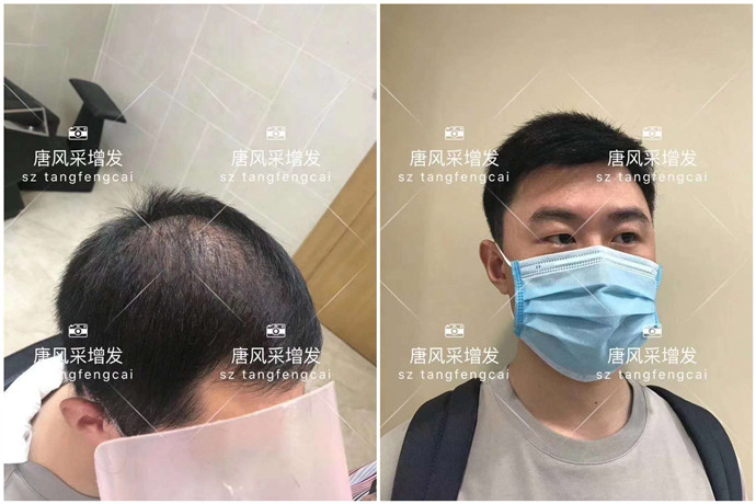 假發什么牌子好 \