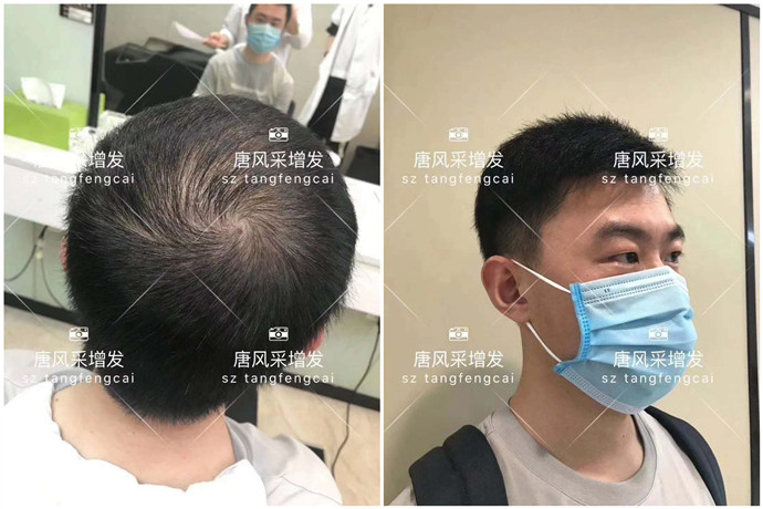 定制假發 \