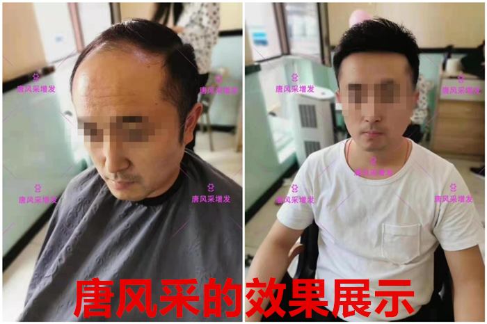 仿真男士假發 \