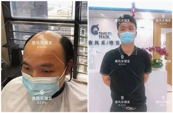 網上男士假發塊哪家好 \