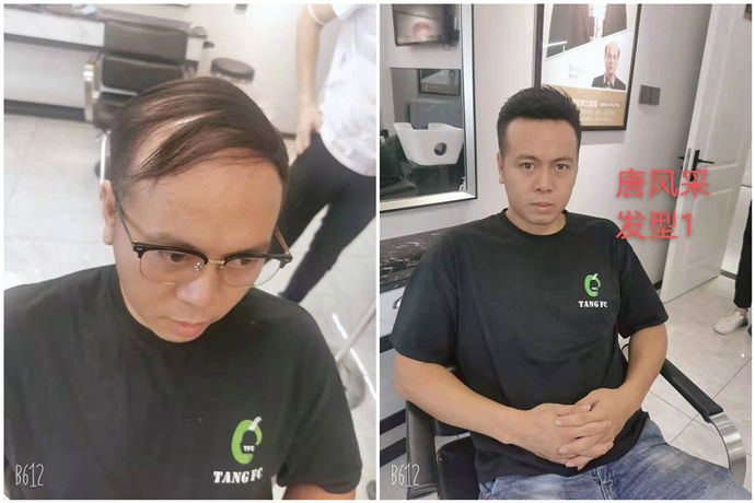 隱形假發 \