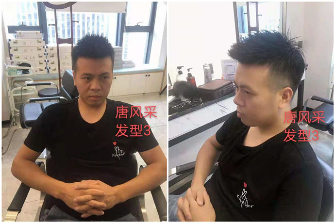 隱形假發 \