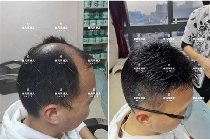 男式假發的價格及圖片 \