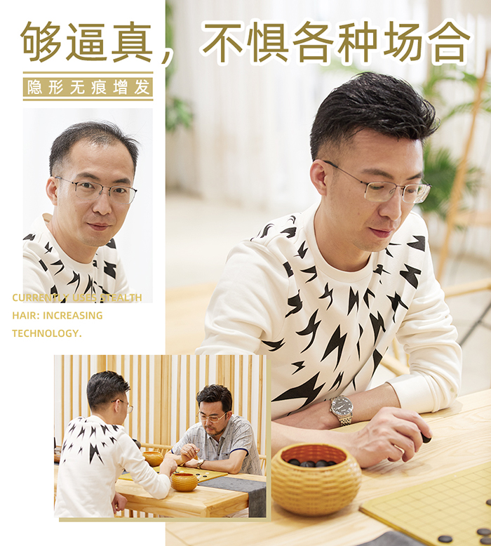 男士增發--后背頭案例 男士增發--后背頭案例