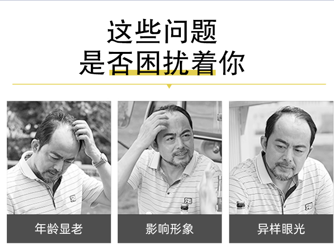 蓋頭頂粘貼假發 \