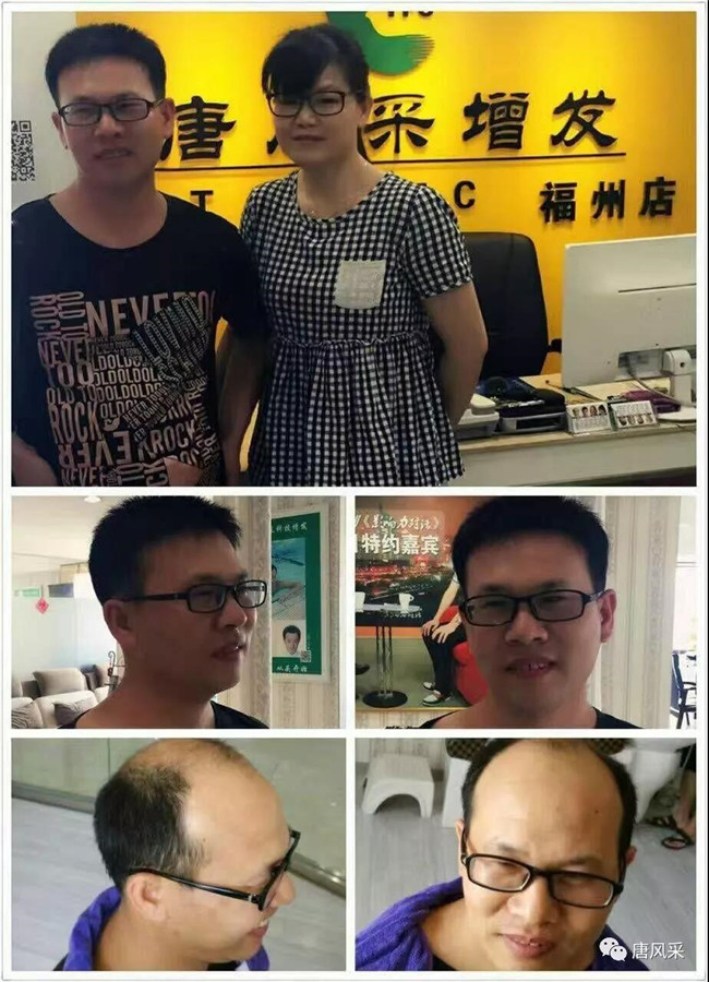 蓋頭頂粘貼假發 \