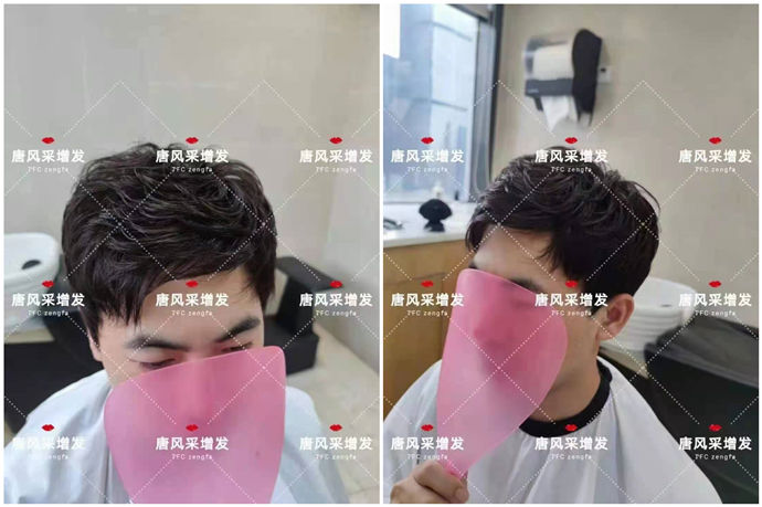 隱形男士假發 \