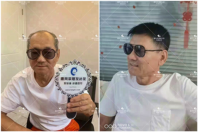 中年人假發套 \