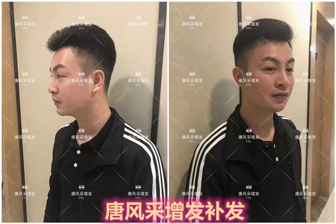 補發效果 \