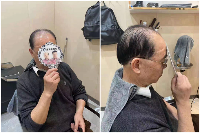 男士隱形補發哪家好 \