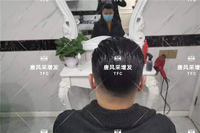 男士頭頂假發片效果好嗎 \