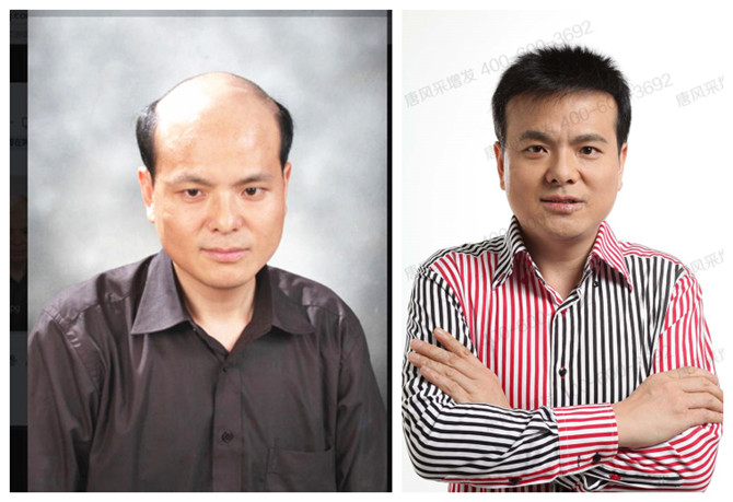 男士假發可以用多久 \