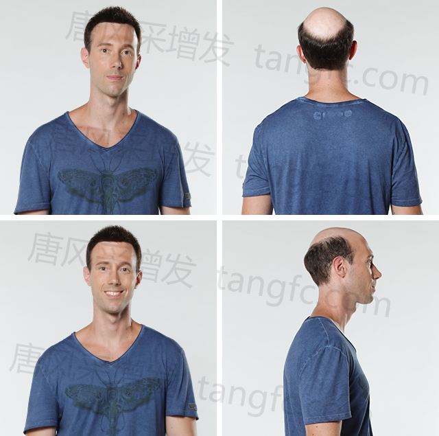 男士假發可以用多久 \