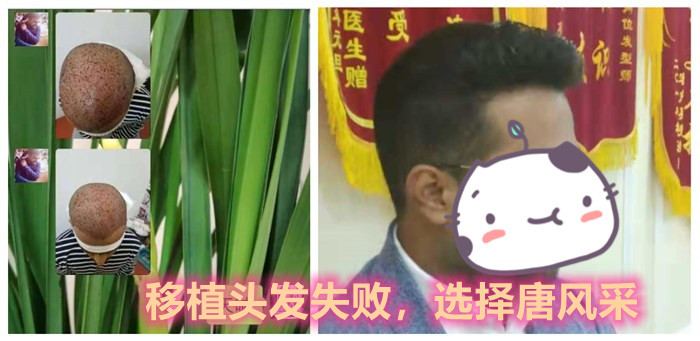 唐風(fēng)采隱形補發(fā) \