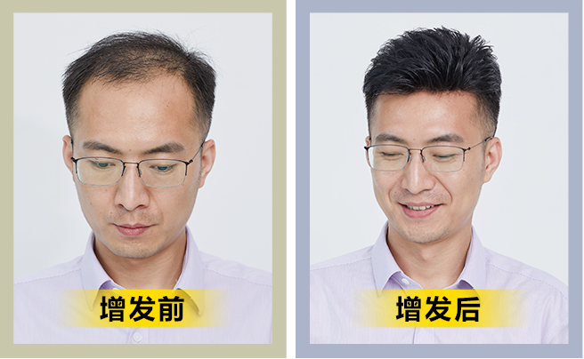 全真人發定制假發 \