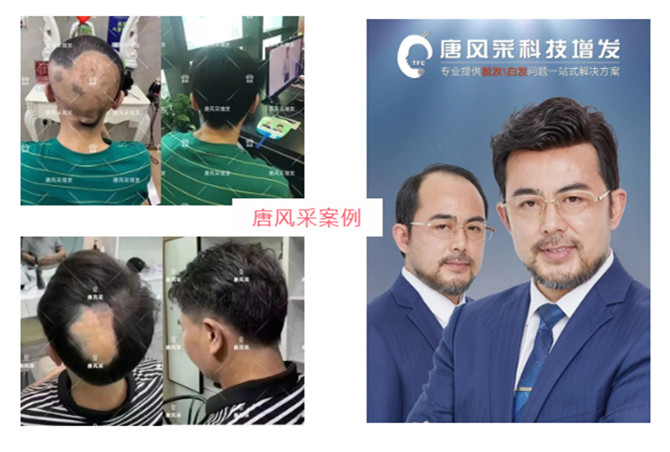 全真人發定制假發 \