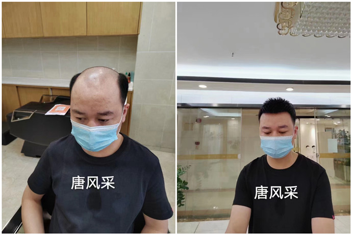 定制男假發 \