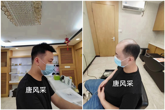 定制男假發 \