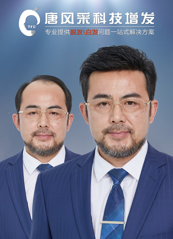 男假發定制 \