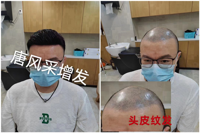 哪里可以定做真人假發 \