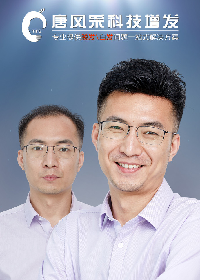 哪里可以定做真人假發 \