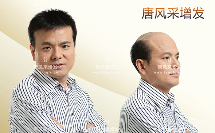 適合四五十歲男士的假發 \