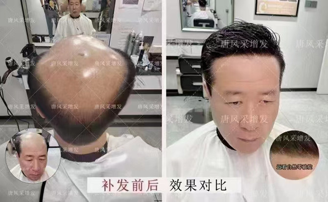 適合四五十歲男士的假發 \