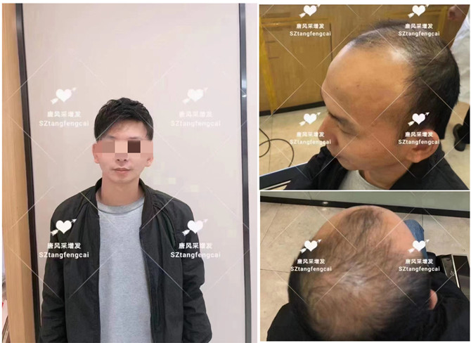 假發可以做平頭嗎 \