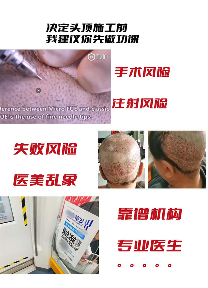 品牌男士假發 \