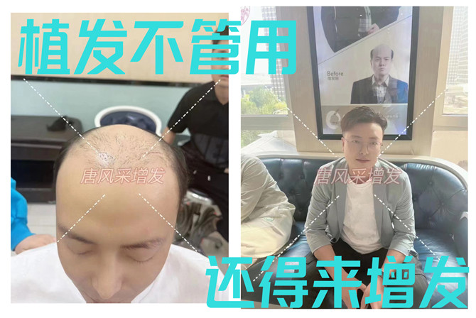 品牌男士假發 \