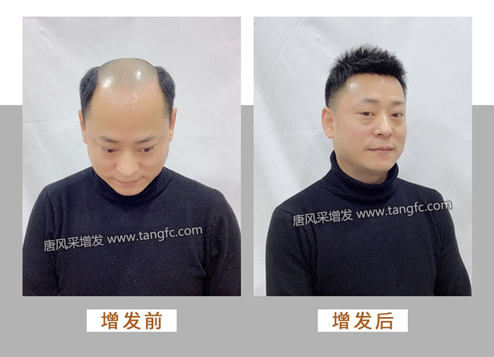 3000塊的假發 \