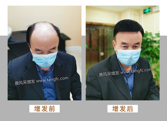 300塊的假發 \