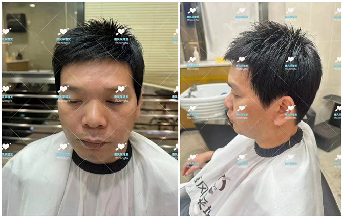 隱形補發塊 \