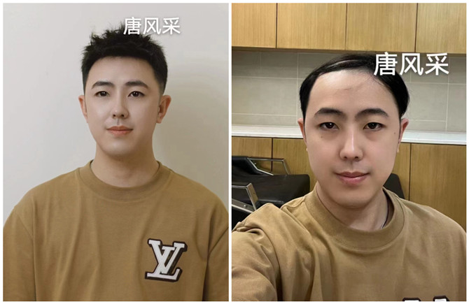 隱形補發塊 官方二維碼 \