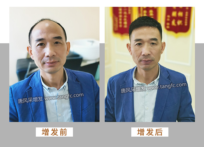 男人戴假發能看出來嗎 \