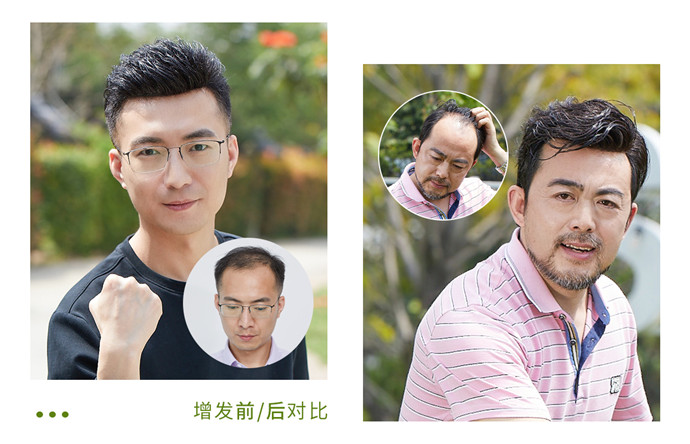 男人戴假發能看出來嗎 \