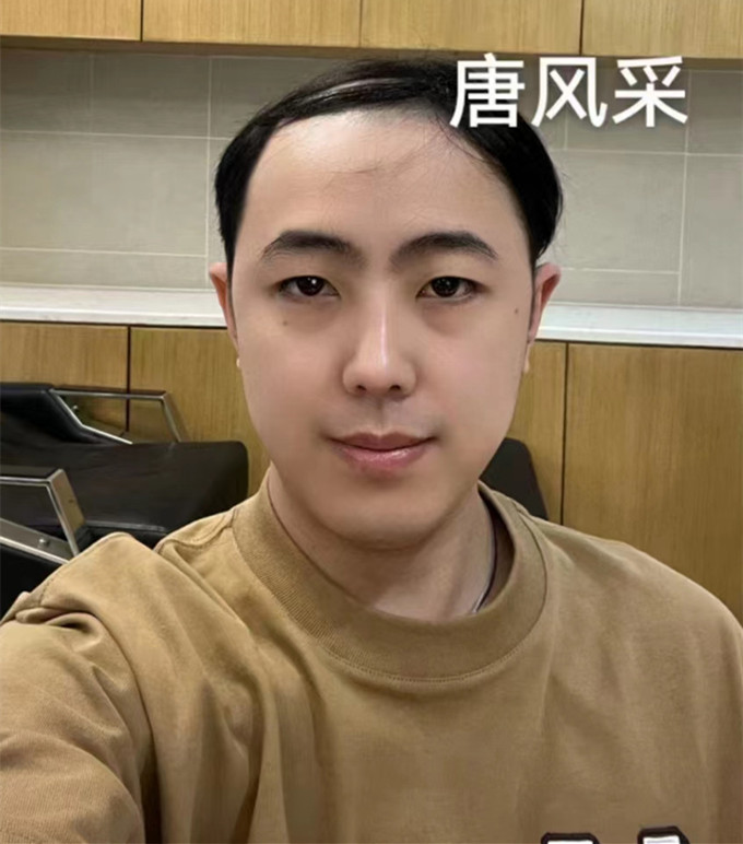 隱形補發 \